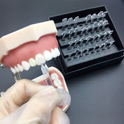 Dental Veneers Composite - 6