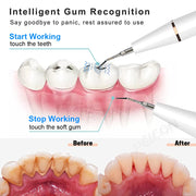 Ultrasonic Dental Scaler For Teeth